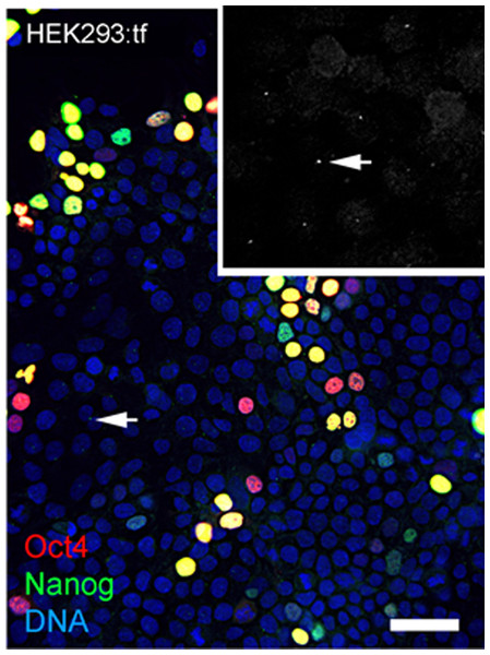 Nanog signal at centrosomes in nontransfected HEK293 cells.