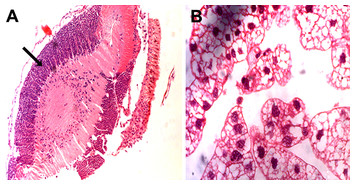 accompanying article image