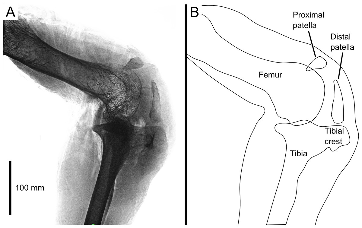 Clinical Anatomy of the Knee  Reumatología Clínica