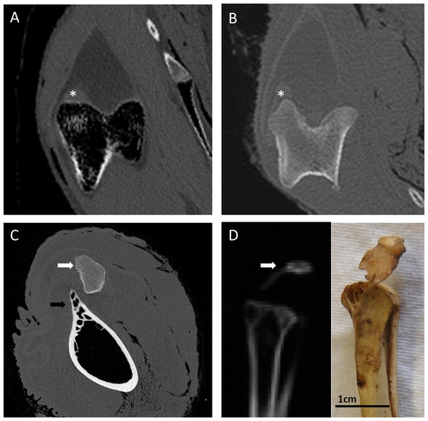 CT images of the patellar region in select Palaeognathae.