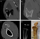 Structure, ontogeny and evolution of the patellar tendon in emus ...