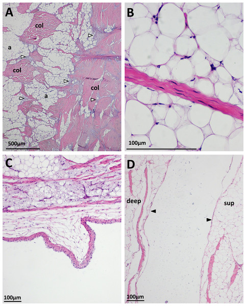 Some histological features of the patellar tendon in emus.