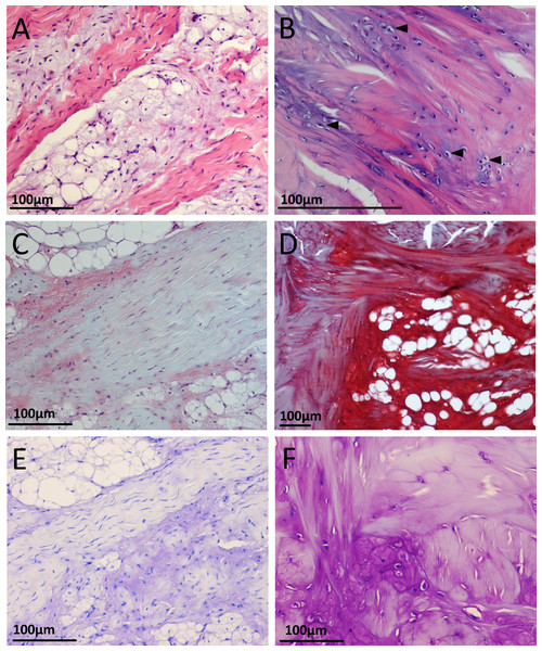 Appearance of cartilage-like tissue within the emu patellar tendon at five weeks (left) and 18 months (right) with different histological stains.