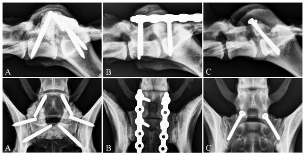 Postoperative radiographs of the three stabilization techniques.