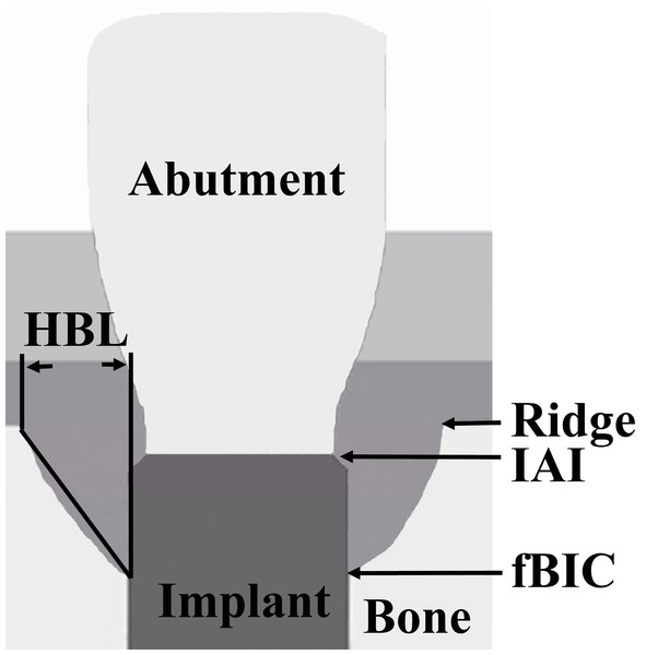 Schematic representation of the landmarks for the measured radiographic parameters.