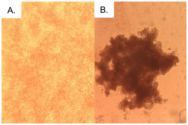 EHL induces agglutination of erythrocytes.