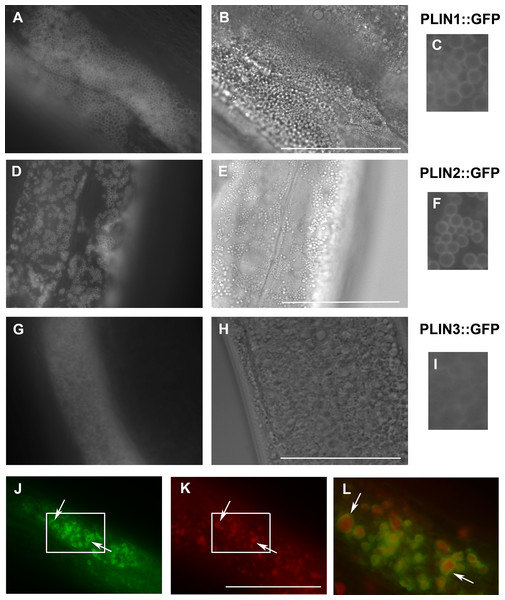 Expression of human perilipins fused to GFP in C. elegans.