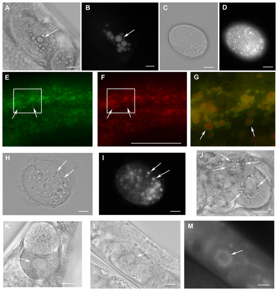 Loss of W01A8.1 function results in abnormal lipid droplet appearance.