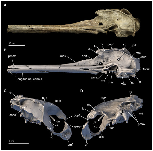 Skull in dorsal, anterior, and posterior views.