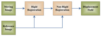 Detection of Alzheimer’s disease by displacement field and machine ...