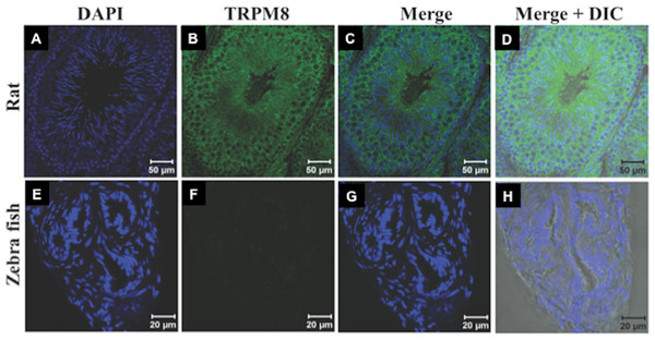 TRPM8 in present in the testis.