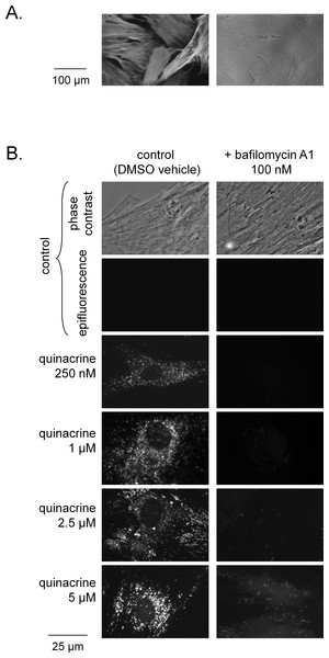 Microscopic evidence of quinacrine accumulation C57BL/6 mouse dermal fibroblasts.