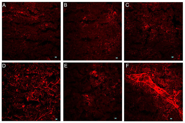 Effects of paclitaxel on glial fibrillary acidic protein (GFAP) immunoreactivity in the anterior cingulate cortex (ACC).
