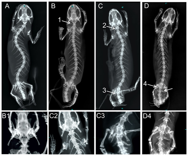 X-ray images of homeotic transformations recorded.