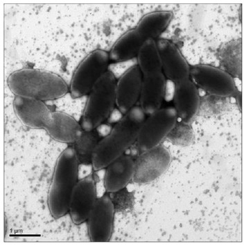 Porphyrobacter mercurialis sp. nov., isolated from a stadium seat and ...