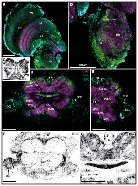 Triple-labeled optical horizontal sections of central brain, lateral protocerebrum, and specific brain areas in Uca tangeri.