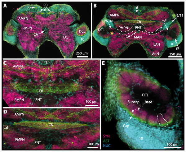 Vibratomy of triple-labeled horizontal vibratome sections of central brain and specific brain areas in Epilobocera sinuatifrons.