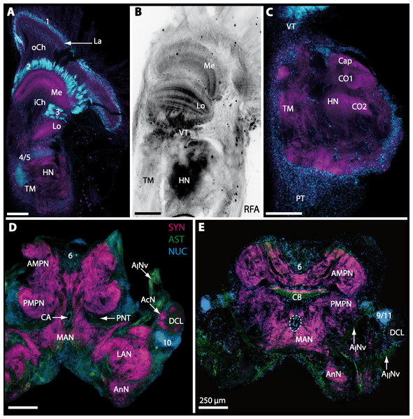 Micrographs of triple-labeled vibratome sections of central brain and lateral protocerebrum in Gecarcoidea natalis.