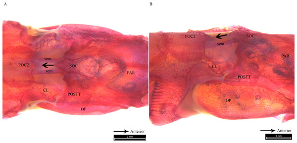 Stained image of Syngnathoides biaculeatus cranium (dorsal and lateral aspect) showing morphology of two bones and the sesamoid bones in epaxial muscles.
