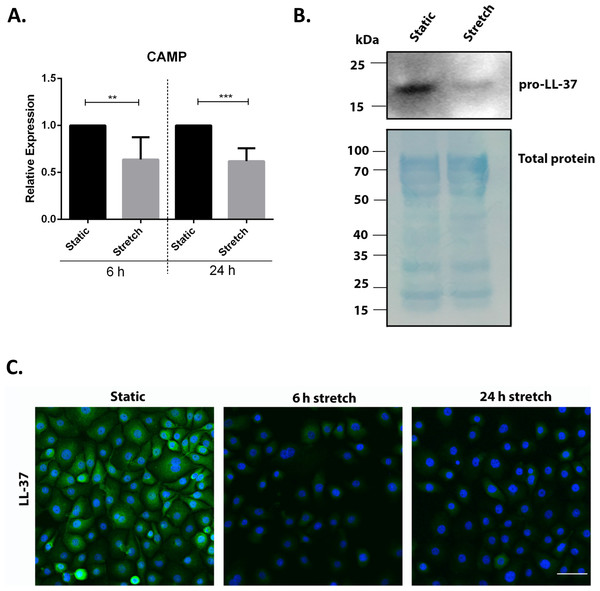 Cyclic mechanical stretch down-regulates cathelicidin antimicrobial peptide expression.