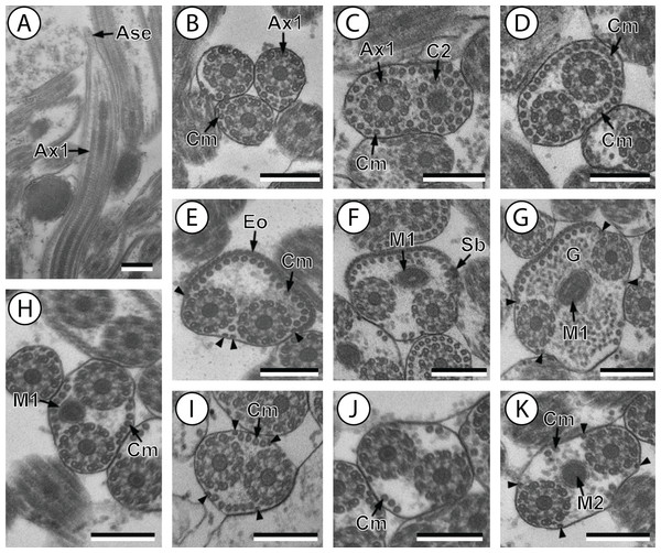 Transmission electron micrographs of mature spermatozoon of Stephanostomum murielae in region I–IV.