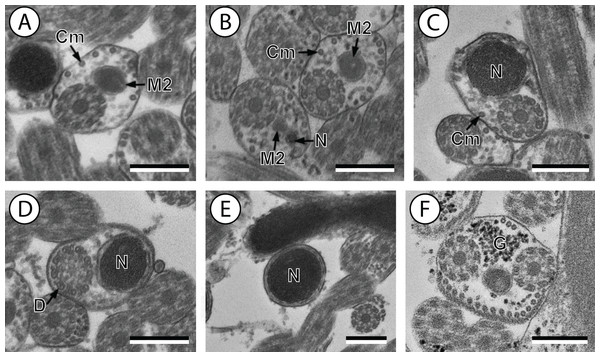 Transmission electron micrographs of mature spermatozoon of Stephanostomum murielae in region IV and V.