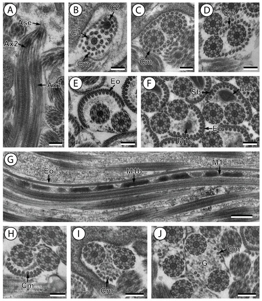 Transmission electron micrographs of mature spermatozoon of Stephanostomoides tenuis in region I–III.
