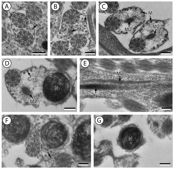 Transmission electron micrographs of mature spermatozoon of Stephanostomoides tenuis in region III–V.