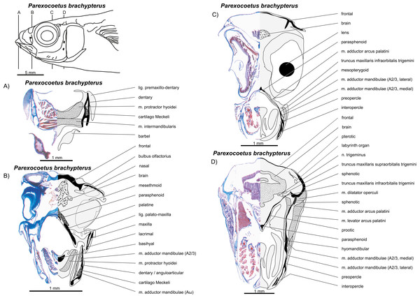 write an essay on jaw suspensorium