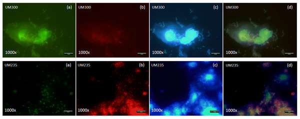 Fluorescence microscopy pictures of Lactobacillus spp., Gardnerella vaginalis and others bacteria species from a healthy (UM300) and a BV (UM235) vaginal clinical samples by specific PNA probes (Lac663 and Gard162) associated with Alexa Fluor 488 and 594 fluorochromes and DAPI staining, respectively.