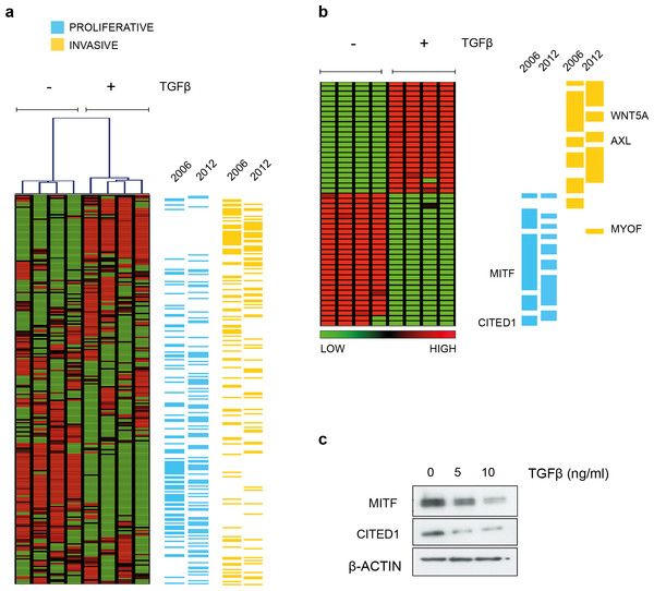 TGFβ induced gene expression in A2058 melanoma cells.