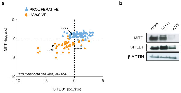 CITED1 expression correlates with MITF expression.