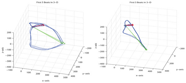 2.5D projections of vectorcardiograms.