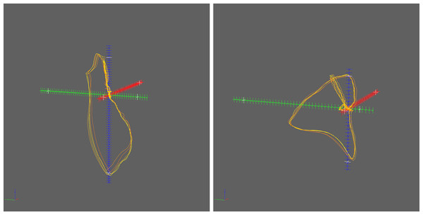 Example of two 3D vectorcardiograms exported by the SaveU3D module.