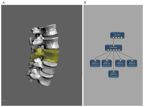 Example of 3D surface meshes converted by MeVisLab using the SaveU3D module.