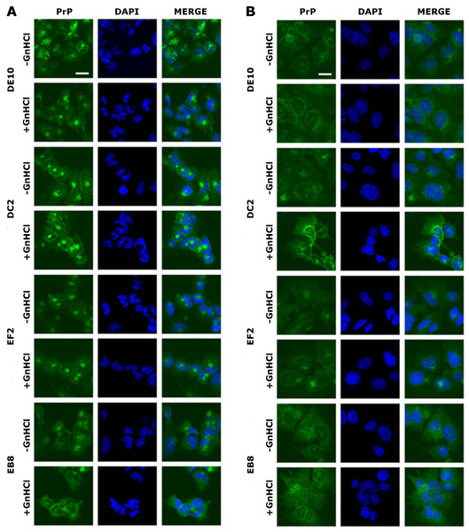 Immunolocalization of PrP in GT1 cells.