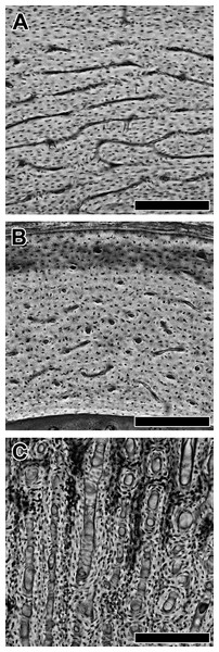 Variation in vascular canal orientation with skeletal element and growth rate in the chicken.