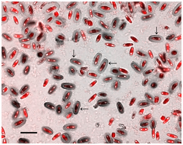 Crystal violet (CV) stained capsules (grey ovals) in xenic A. minutissimum biofilm (scale bar: 20 µm).