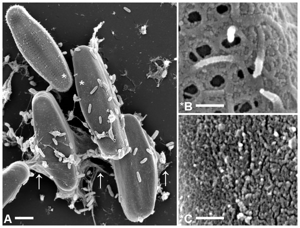 Comparison of microstructures on A. minutissimum cell surfaces in a xenic biofilm.