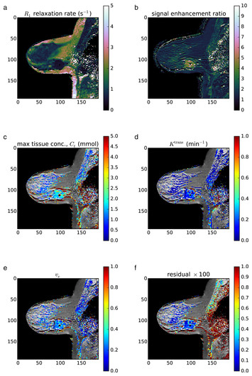 DCEMRI.jl: a fast, validated, open source toolkit for dynamic contrast ...