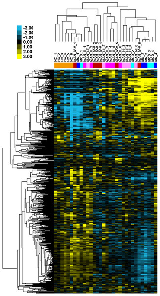 Global urinary miRNA profiling in patients with IgAN and controls.