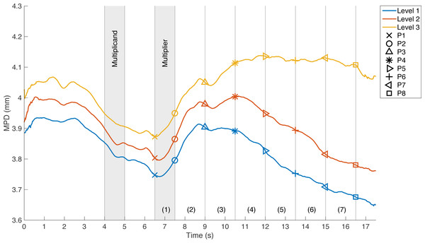Mean pupil diameter (MPD) during the mental multiplication task for the three levels of difficulty.