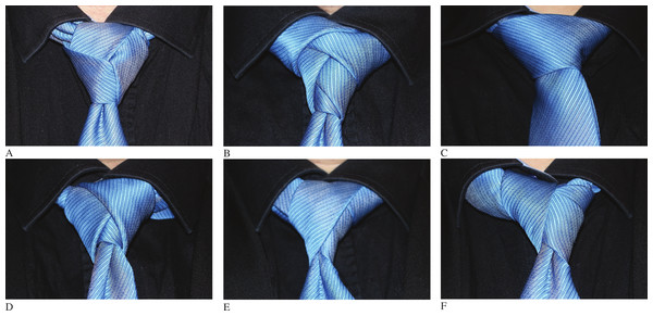 Some specific tie-knot examples.