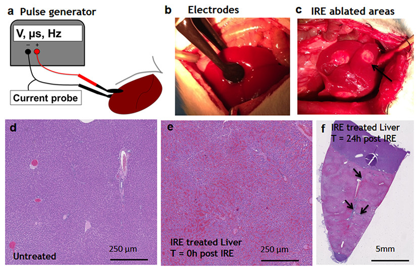 Rat Liver Regeneration Following Ablation With Irreversible