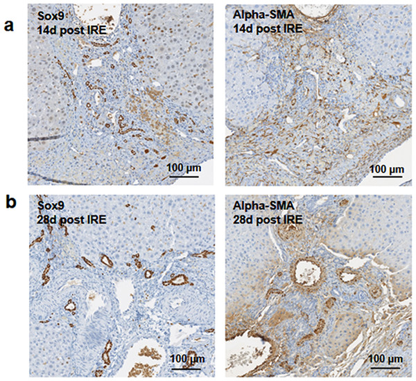 Immunohistochemistry of ablated zones-late events.