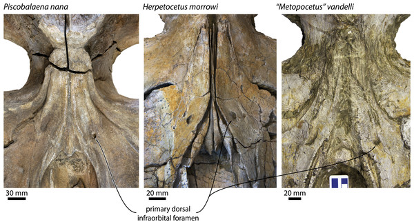 Primary dorsal infraorbital foramen of various cetotheriids.