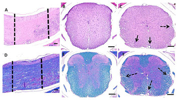 experimental autoimmune encephalomyelitis spinal