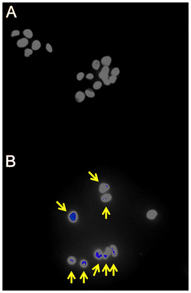 Fluorescence immunohistochemistry for γH2AX foci in γ-irradiated HepG2 cells.