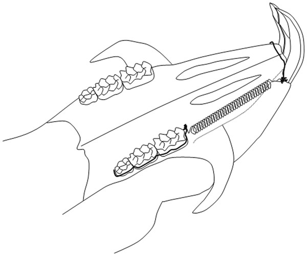 Schematic drawing of the orthodontic appliance.