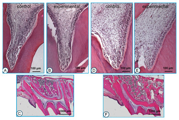 Age-related changes of dental pulp tissue after experimental tooth ...